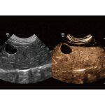 УЗД апарат для тварин Vetus 9 Premium Mindray Animal, фото 4