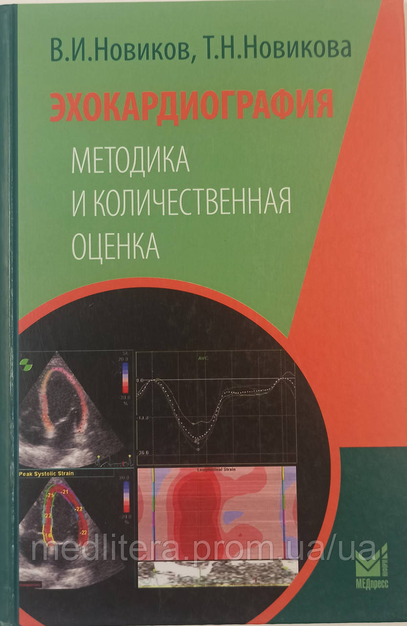 Новиків, Т.Н. Новикова ЕХОКАРДІОГРАФІЯ МЕТОДИКА І КІЛЬКІСНА ОЦІНКА, фото 1