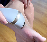 Електрична пилочка для видалення мазолів на п'яті., фото 5