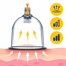 Вакуумні масажні банки 4FIZJO для тіла (кітайські/атнікелюлітні банки) 12 шт. з помпою 4FJ0579 Poland, фото 5
