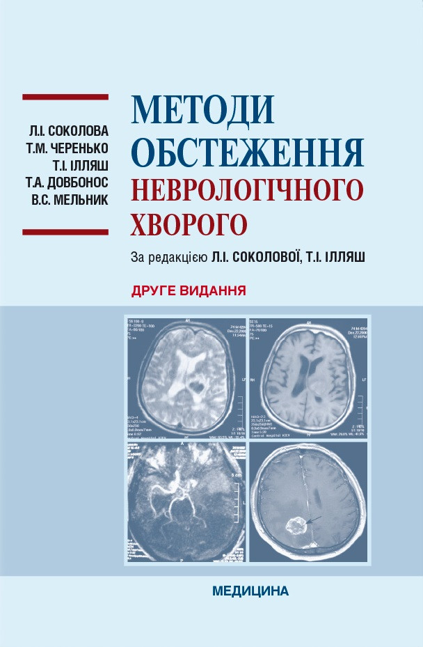 Методи обстеження неврологічного хворого. 2-е видання