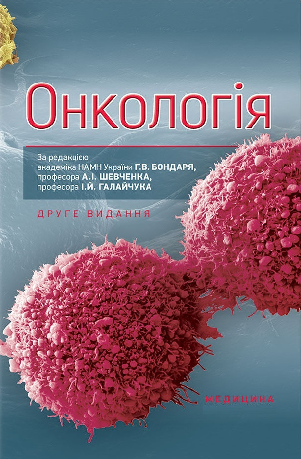 Онкологія. 2-е видання