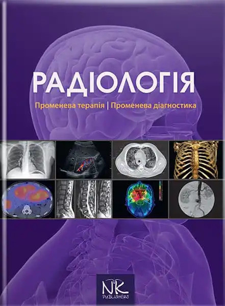 Радіологія. Променева терапія. Променева діагностика. 2-ге видання. Ковальський О. В. та ін.
