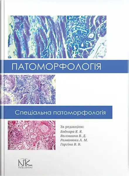 Патоморфологія. Спеціальна патоморфологія. Боднар Я. Я., Волошина В. Д., Романюк А. М., Гаргіна В. В. (за