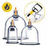 Вакуумні масажні банки 4FIZJO для тіла (китайські/атницелюлітні банки) 24 шт з помпою (P-5907739319913), фото 8