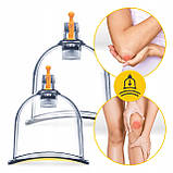 Вакуумні масажні банки 4FIZJO для тіла (китайські/атницелюлітні банки) 24 шт з помпою (P-5907739319913), фото 10