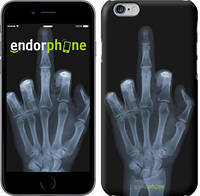 Чехол на iPhone 6 Рука через рентген "1007c-45"