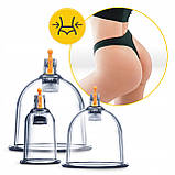 Вакуумні масажні банки 4FIZJO для тіла (китайські/атницелюлітні банки) 24 шт з помпою (P-5907739319913), фото 5