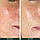 Крем проти почервоніння на шкірі Sorted Skin 5 In 1 Anti-Redness Day Cream 30 мл, фото 5
