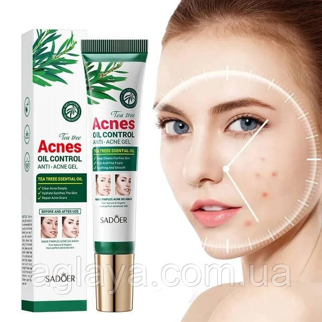 Крем гель проти акне та прищів з олією чайного дерева SADOER TEA TREE ACNES OIL CONTROL GEL 20 мл