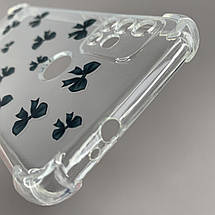 Чохол для Motorola G20 чохол з бронь кутами з принтом чорних бантиків на телефон моторола г20 прозорий q03v, фото 4