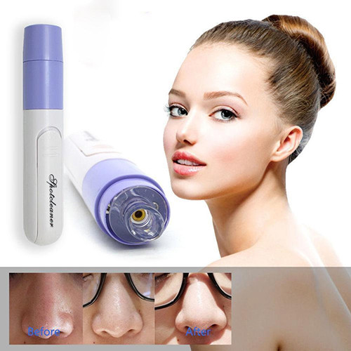 Вакуумний очищувач обличчя Spotcleaner, фото 1