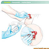 Гемостатичний бинт Kaolin Hemostatic Z-Fold Gauze кровоспинна пов'язка кровоспас гемостатик целокс кровоспинна серветка, фото 4