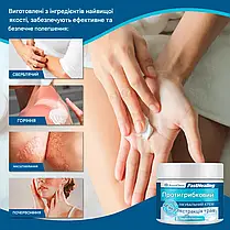 Roycederm Antifungal Defense натуральний протигрибковий засіб, фото 6
