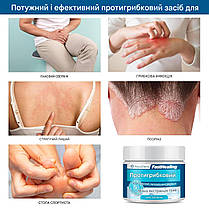 Roycederm Antifungal Defense натуральний протигрибковий засіб, фото 5