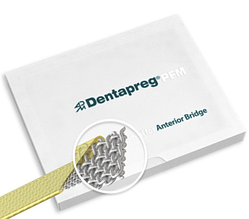 Стрічка для шинування зубів Dentapreg PFM 3 х 0,3 х 50 мм