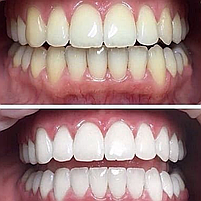 Ультразвукова зубна щітка Medica+ PROBRUSH 9.0 white, фото 7
