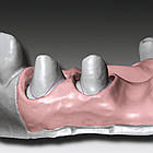 GINGIFAST CAD RIGID 2*50ml, А-силікон, фото 4