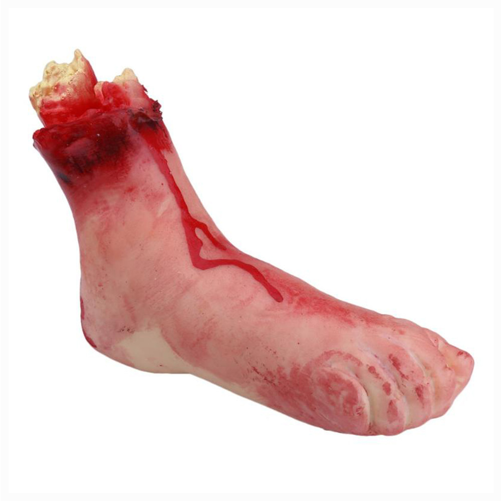 Відірвана нога, фото 1