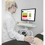 Денситометр EchoStation, фото 9