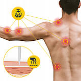 Голки акупунктурні 4FIZJO 0.3 х 30 мм з направляючою 100 шт (P-5907739318947), фото 3