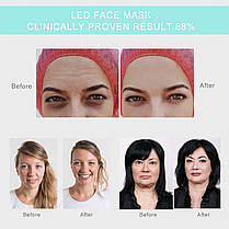 PHASZ PDT LED Light Therapy Фотодинамічний догляд за шкірою обличчя Омолодження Фотонна терапія Апарат., фото 5