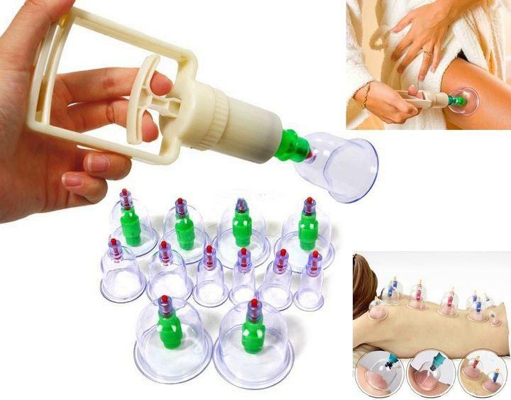 Банки вакуумні 12 ШТ, фото 1