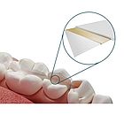 Dentapreg Splint,Дентапрег,Шинуюча стрічка SFU,50х2х0,2 мм, фото 4