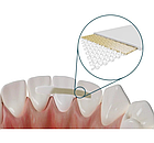 Dentapreg Bridge, Дентапрег, Шинирувальна стрічка PFM, 50х3х0,3 мм, фото 5