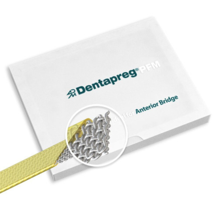 Dentapreg Bridge, Дентапрег, Шинирувальна стрічка PFM, 50х3х0,3 мм, фото 1