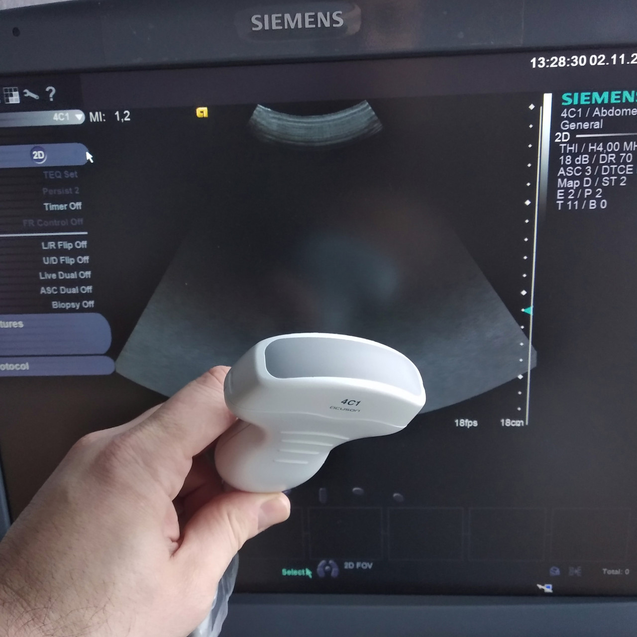 Конвексний ультразвуковий датчик Siemens Acuson 4C1, фото 1