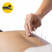 Голки акупунктурні 4FIZJO 0.25 х 25 мм з напрямною 100 шт (P-5907739318930), фото 4