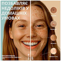 Електрокоагулятор Swan Beauty Y-3.0 для видалення папілом та бородавок плазмова ручка біла, фото 3