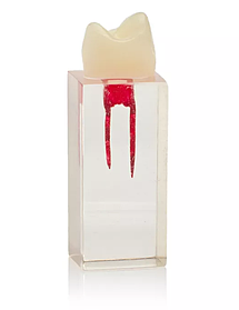 Стоматологічний навчальний блок Endo (премоляр, два канала) HST-N5/2