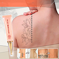 Крем для видалення небажаних татуювань, для кольорових та чорних татуювань