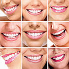 Система відбілювання зубів на батарейках, Dental White / LED відбілення зубів / Засіб для відбілювання зубів, фото 3