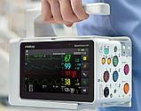 Монітор пацієнта Mindray BeneVision N1 Transport Monitor/Module, фото 3