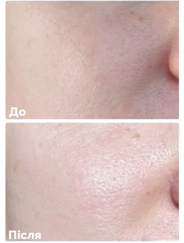 Мягкий очищающий гель Needly Mild Cleansing Gel