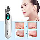 Очищувач для обличчя, 3 насадки, від USB, SK-319 / Апарат для чищення обличчя / Очищувач пор обличчя, фото 2