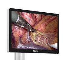 Монітори ендоскопічні