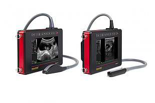 УЗД-сканер iScan 2