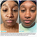 Крем із ретинолом проти пігментації Urban SkinRX Retinol Rapid Repair & Dark Spot Treatment 14 мл, фото 3