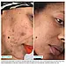 Крем із ретинолом проти пігментації Urban SkinRX Retinol Rapid Repair & Dark Spot Treatment 14 мл, фото 9