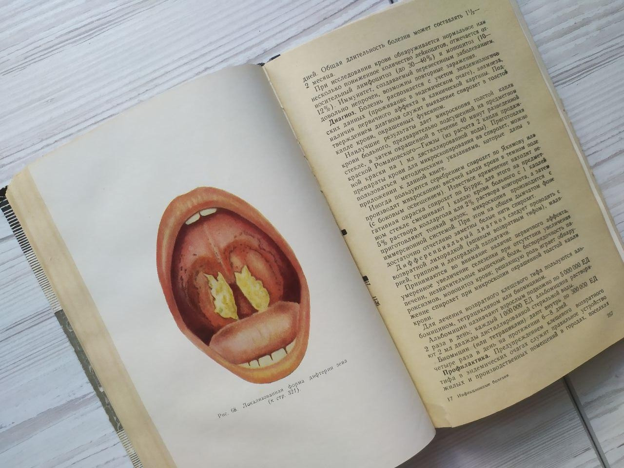 Product image preview