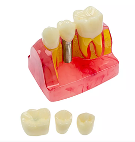 Модель демонстраційна часткова