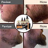 Чоловічий набір 12 в 1 з триммером для догляду за бородою та вусами Coiple Beard, стимуляції росту та створення форми, фото 7