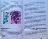 Полонська Цитологічне дослідження цервікальних мазків Пап-тест, фото 4