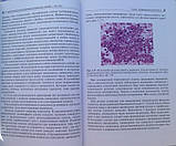 Полонська Цитологічне дослідження цервікальних мазків Пап-тест, фото 6
