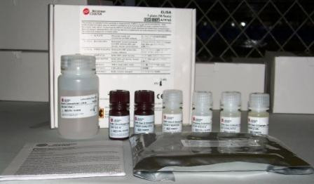 Имуноферментные тест-системи Beckman Coulter, США