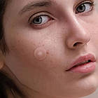 Пластир від папілом та бородавок, 30 шт / Набір пластирів проти бородавок / Точкові патчі від папілом, фото 2